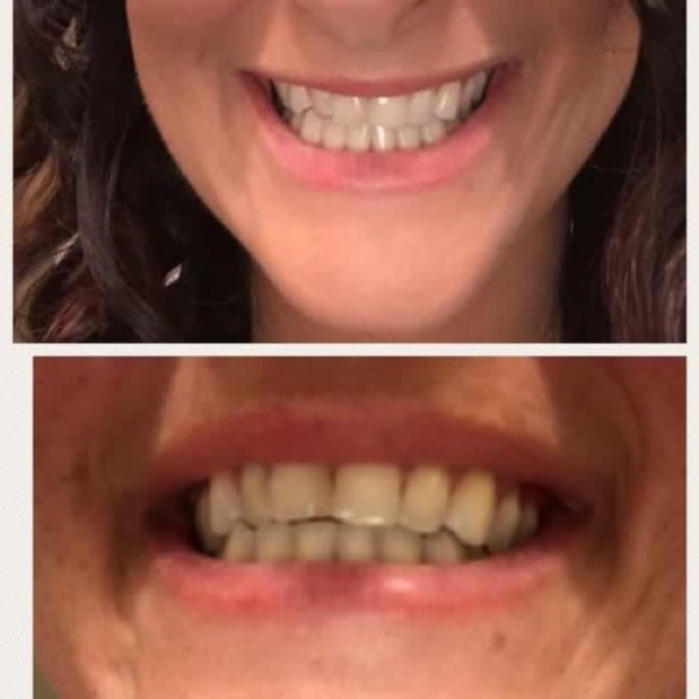Whitening Toothpaste!